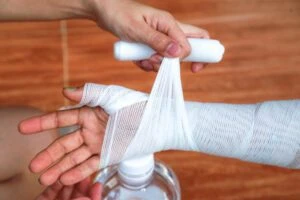 Doctor applying bandage on patient's burn arm