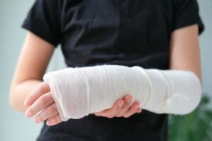 Close-up of a broken arm of a child after injury