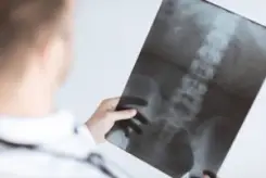 doctor examining a patient’s x-ray