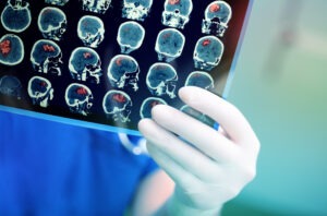 doctor attentively examining mri scan patient