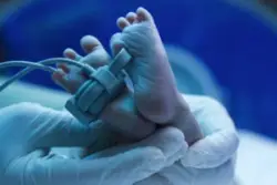 A baby's feet with monitors attached