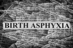 The words birth asphyxia printed on strips of paper