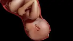 What Happens If a Baby Stays in the Birth Canal Too Long