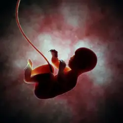 What Are The Different Kinds Of Umbilical Cord Birth Injuries You Can Sue for