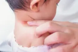 doctor highlights nerve damage in child’s neck
