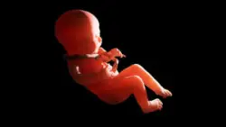 rendering of fetus choked by umbilical cord