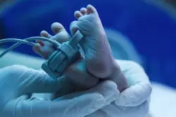 newborn baby under ultraviolet lamp