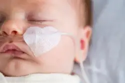 Baby With Hypoxic Ischemic Encephalopathy Receives Oxygen