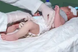 child suffering from hypoxic ischemic encephalopathy
