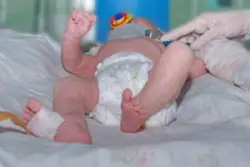 a doctor is using a phonendoscope on a newborn