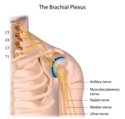 If a baby’s neck gets stretched too much, damage to the brachial plexus nerves can happen. This chart shows where these nerves lie in the neck and arm.