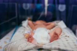 Newborn Baby With Birth Injury In Michigan