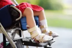 A close-up of the legs of a young girl sitting in a wheelchair.