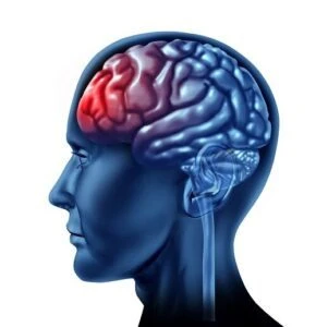 Brain Injury Awareness Month: Disability Benefits for Traumatic Brain Injuries