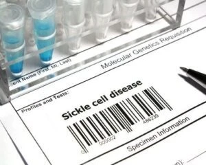 Medical Evidence needed for Sickle Cell Social Security Disability