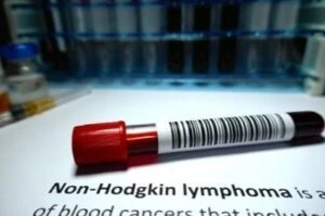 What Is the VA Disability Rating for Non-Hodgkin’s Lymphoma?