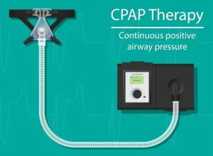 Continuous,Positive,Airway,Pressure,(cpap),Therapy,Treatment,Obstructive,Sleep,Apnea