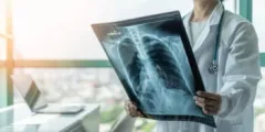 Médico revisando radiografía de tórax. Abogado de lesiones catastróficas en Destin