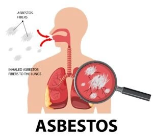 Can I Sue My Employer for Exposure to Asbestos?