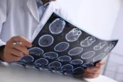 A doctor is examining brain scan images.