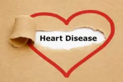 A heart drawn around the text "Heart Disease" appearing behind torn brown paper. Uncover the heart problems that qualify for disability.