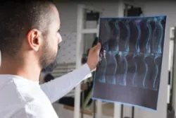 a radiologist checking x-ray images for signs of spinal injury