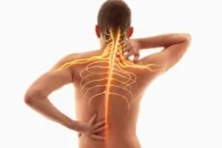 Nervous system concept. You can get Social Security Disability benefits for nerve damage with help from an experienced disability lawyer.