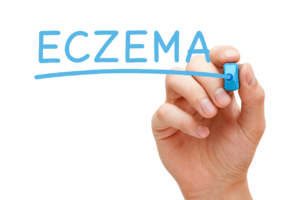 Does Sugar Contribute to Eczema in Children?