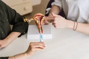 model of IUD device