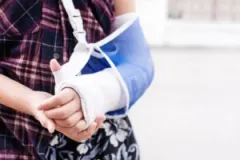 A person with an injured arm. A personal injury lawyer in Fishers, Indiana, can build your legal claim.