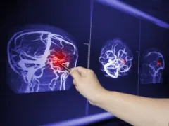 Traumatic brain injury scan. A Fort Wayne traumatic brain injury lawyer can help ensure you’re treated fairly