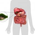 Car Accident Cause Gallbladder Problems