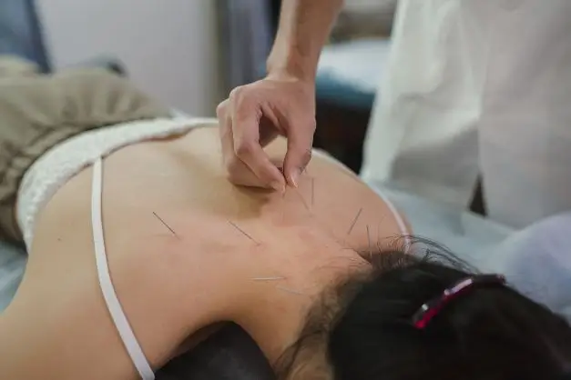 Acupuncturist Licensing and Disciplinary Actions