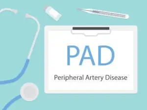 Pittsburgh Peripheral Artery Disease Lawyer