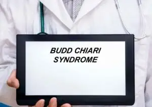 Pittsburgh Budd-Chiari Syndrome Lawyer