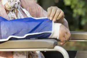 an elderly woman with a broken arm