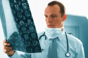 doctor looking at brain x-rays