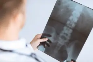 doctor looking at spinal cord x-ray