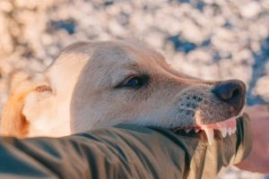 dog biting a guy’s arm