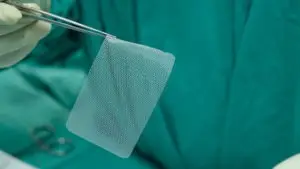 hernia mesh in the OR