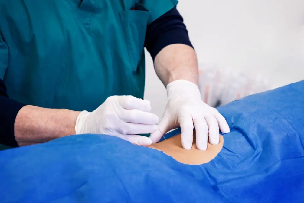 What Are The Benefits and Risks Of Hernia Mesh Repair?