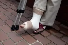 Man with broken foot after a truck accident.