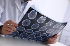 doctor reviewing brain mri scans of pembroke pines patient