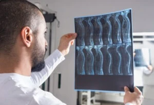 A doctor examining a spinal cord injury victim's x-rays to determine if they are eligible to file a lawsuit.