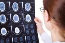 A woman holding up an xray of an individual's brain