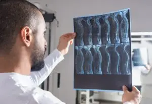 A doctor looks at an X-ray of a spine injury.