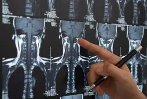 MRI-of-a-person’s-vertebrae