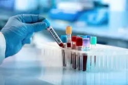 Ohio Supreme Court Clarifies How to Admit Blood Test Evidence in OVI Cases