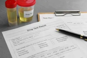 Yes, you will have to submit to drug testing while you’re on probation for a DUI. Drug testing is a standard condition of many probation and parole programs.