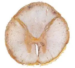 A cross-section of the spinal cord.